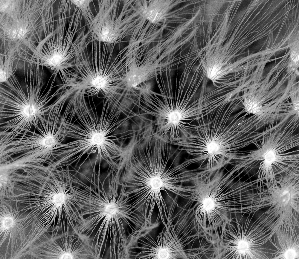 macro